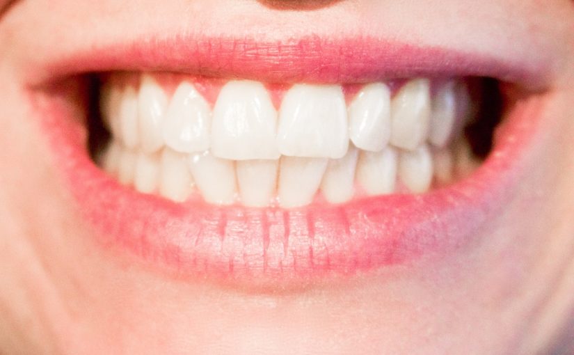Obecna technika stosowana w salonach stomatologii estetycznej zdoła sprawić, że odzyskamy śliczny uśmiech.